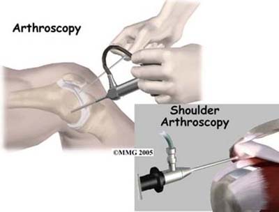 general_arthroscopy_intro