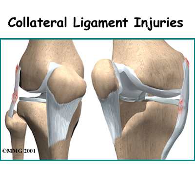 knee_collateral_intro01