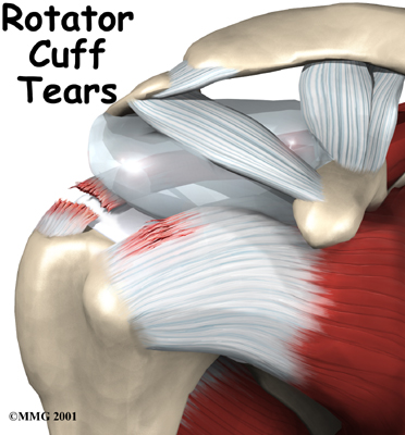 shoulder_rotator_cuff_intro01