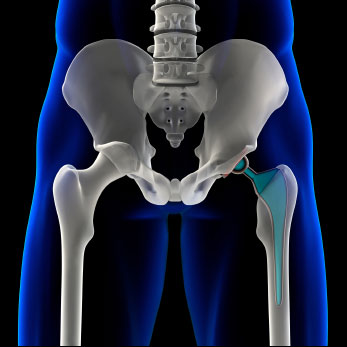 hip-joints
