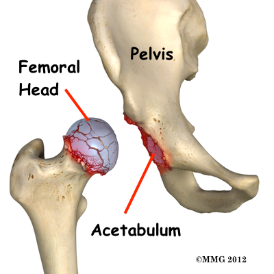 THR_Anterior_Anatomy_02