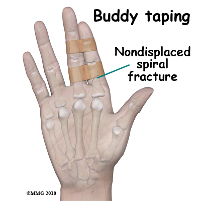 adult_finger_fx_buddy_taping