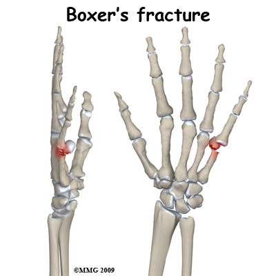 adult_hand_fx_boxers