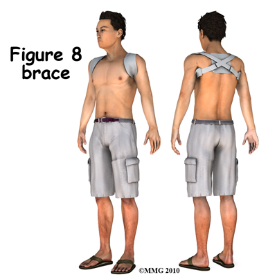 adult_shoulder_fx_figure_8_brace