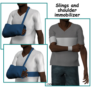 adult_shoulder_fx_treatment01