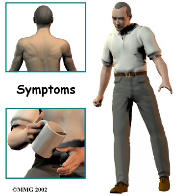 cervical_stenosis_symptom01