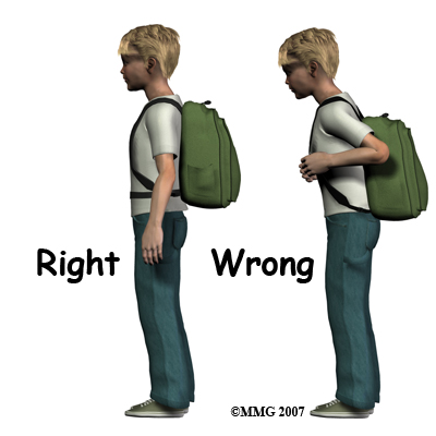 child_back_pain_backpack