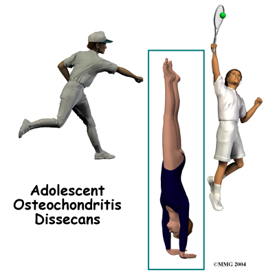 child_elbow_OCD_intro01