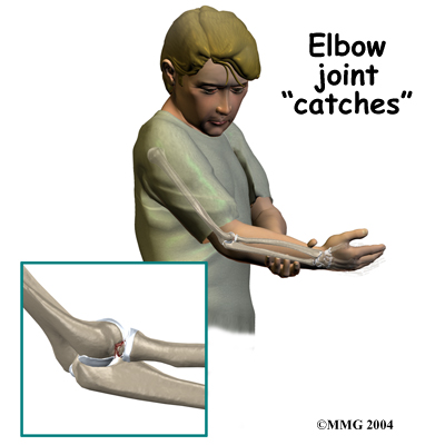 child_elbow_OCD_symptom01