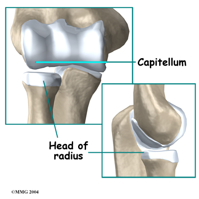 child_elbow_dislocate_anatomy02