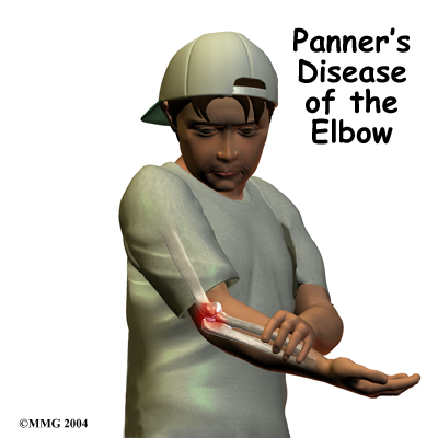 child_elbow_panners_intro01