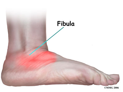 child_foot_tarsalco_sympt01