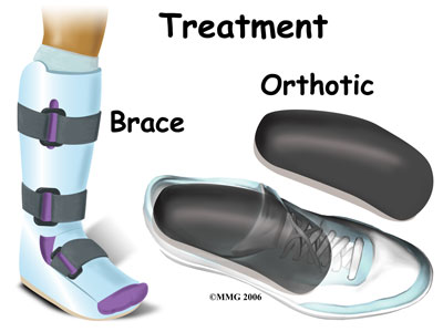 child_foot_tarsalco_treat01