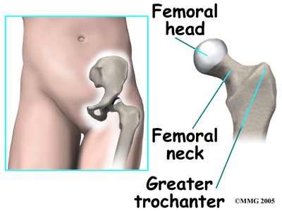 child_hip_devel_dysp_anatomy01