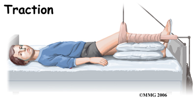 child_hip_perthes_treatment01