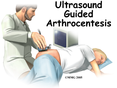 child_hip_septic_treatment01