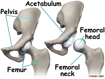 child_hip_slipped_cfe_anatomy01