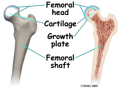 child_hip_slipped_cfe_anatomy03