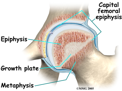 child_hip_slipped_cfe_anatomy05