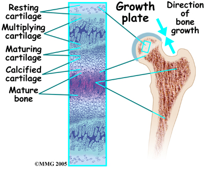 child_hip_slipped_cfe_anatomy07