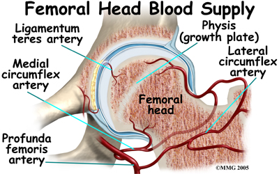 child_hip_slipped_cfe_anatomy09