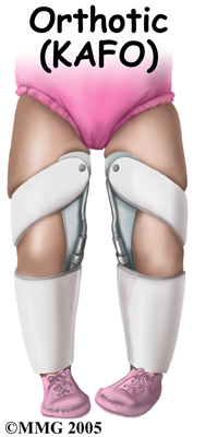 child_knee_blounts_treatment01