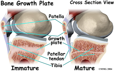 child_knee_jumpers_causes04