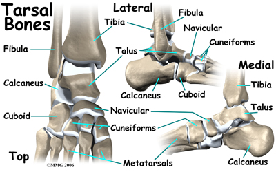 child_limp_foot_anatomy03