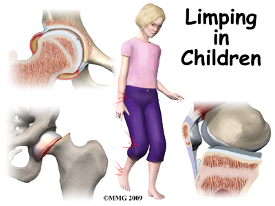 child_limping_intro01