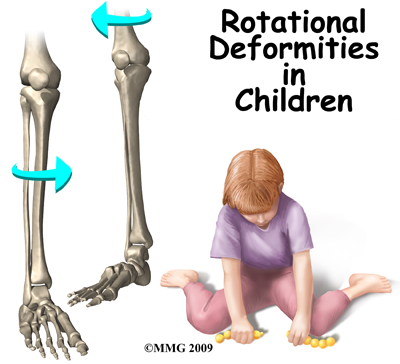 child_rotational_def_intro01