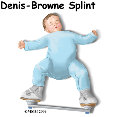 child_rotational_def_rehab01