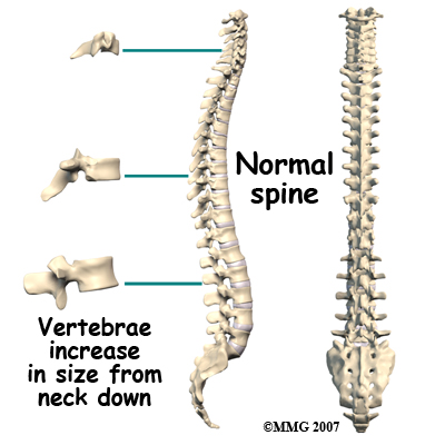 child_scoliosis_anatomy02