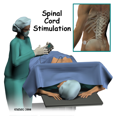 crps_surgery01