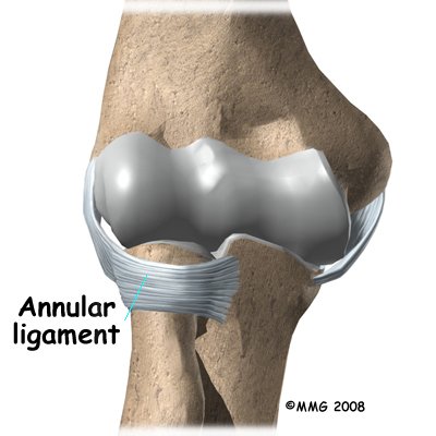 elbow_dislocation_anatomy05
