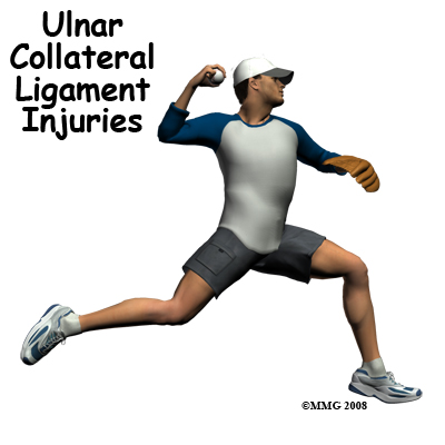 elbow_ucl_injury_intro01