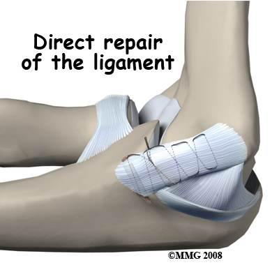 elbow_uclr_direct