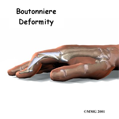 finger_bouton_intro01