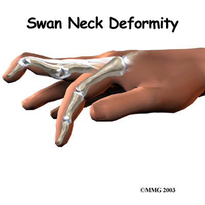 finger_swanneck_intro01