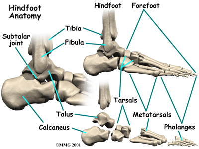 foot_acquired_flatfoot_anat01