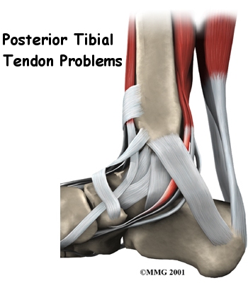 foot_posterior_tibial_tendon_intro01