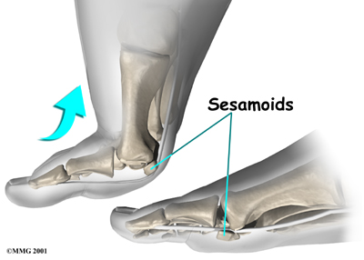foot_sesamoiditis_anat03