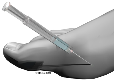general_gout_treatment01