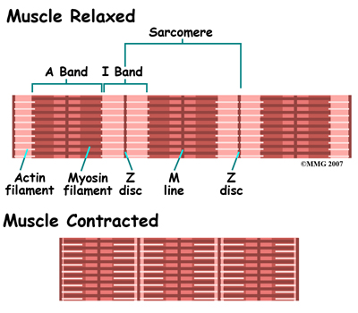 general_muscle_cramps_causes01