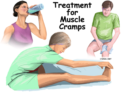 general_muscle_cramps_treatment01