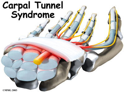 hand_carpal_tunnel_intro01