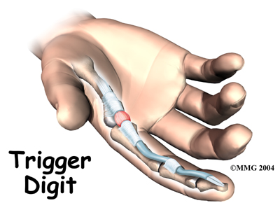 hand_trigger_digit_intro01