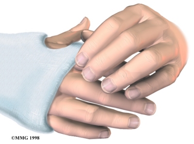 handcast