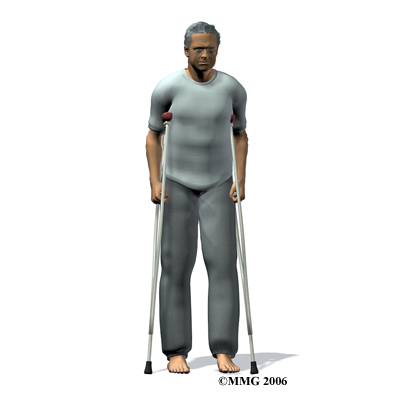 hip_arthroplasty_resurface_rehab01