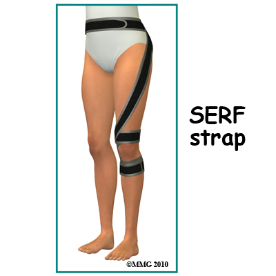 hip_labral_tear_SERF_strap