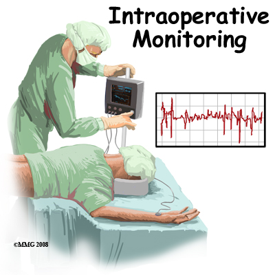 intraop_monitoring_intro01
